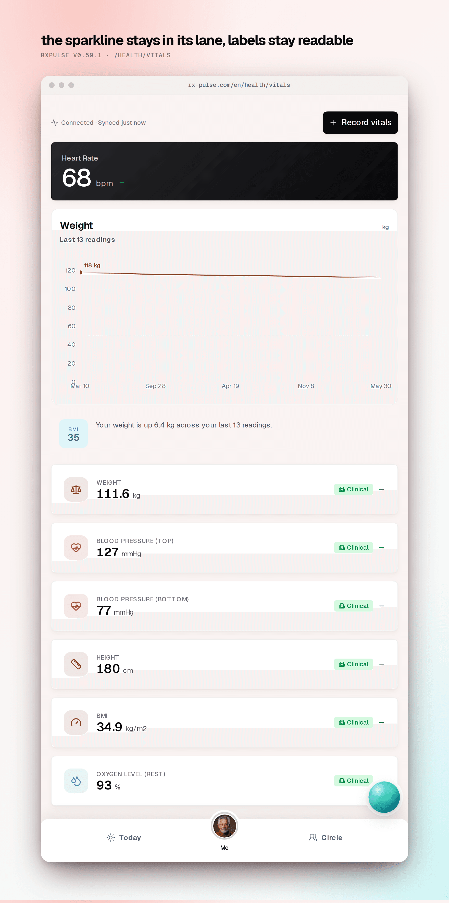 Vitals page with each trend sparkline constrained to its own column so the metric names and values beside it stay readable.